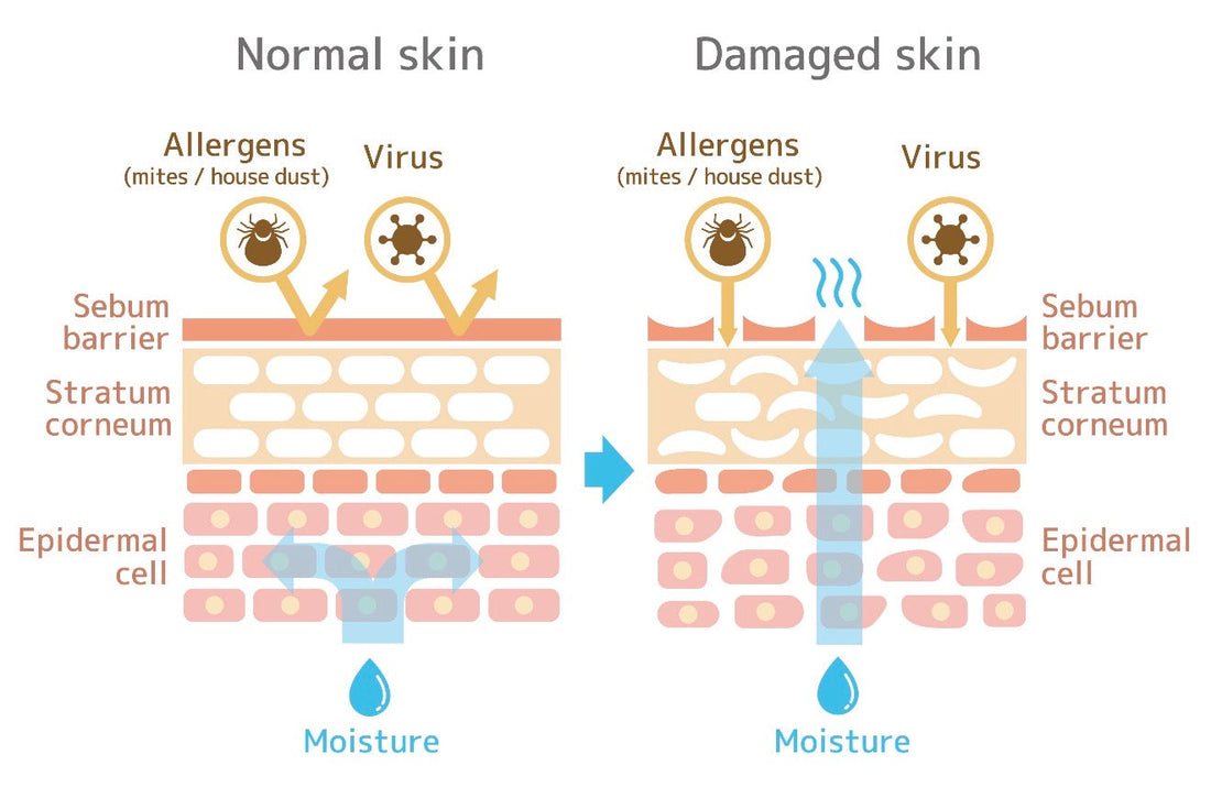 Is Your Skin Red or Itchy? How to Fix Your Skin Barrier