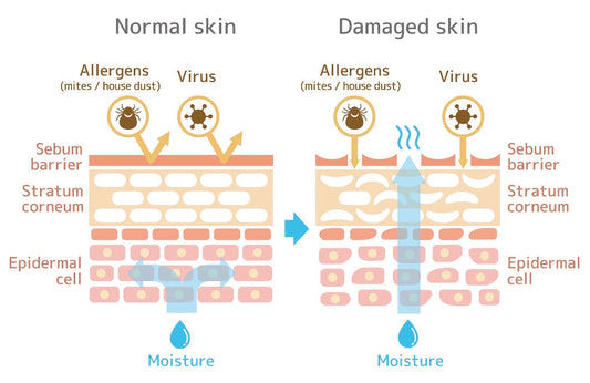 Is Your Skin Red or Itchy? How to Fix Your Skin Barrier